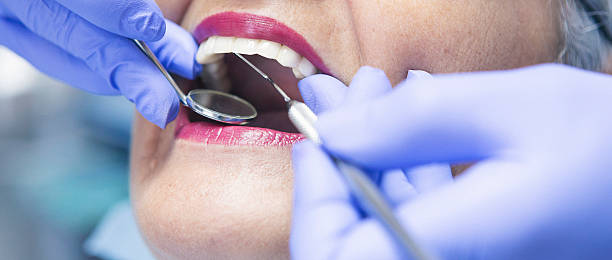 Best Dental Abscess Treatment in New Miami, OH